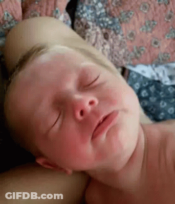 A Baby Is Sleeping On A Bed With His Eyes Closed And His Face Is Covered In Red Spots . GIF