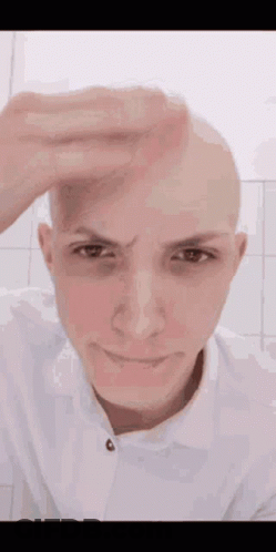 A Bald Man Is Holding His Hand To His Forehead And Smiling . GIF