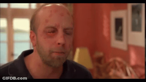 A Bald Man With A Beard And A Black Eye GIF