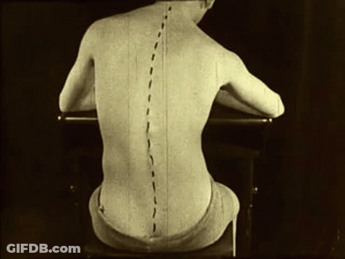 A Black And White Photo Of A Man 'S Back With Lines Drawn On It GIF