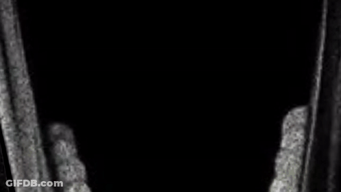 A Black And White Photo Of A Person Screaming With Their Mouth Open . GIF