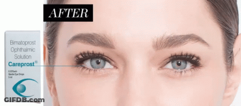 A Box Of Bimatoprost Ophthalmic Solution Next To A Woman 'S Eye GIF