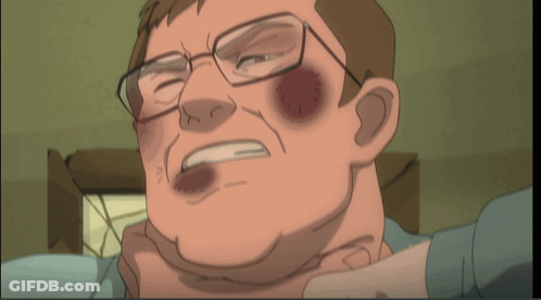 A Cartoon Of A Man With Glasses And A Black Eye GIF