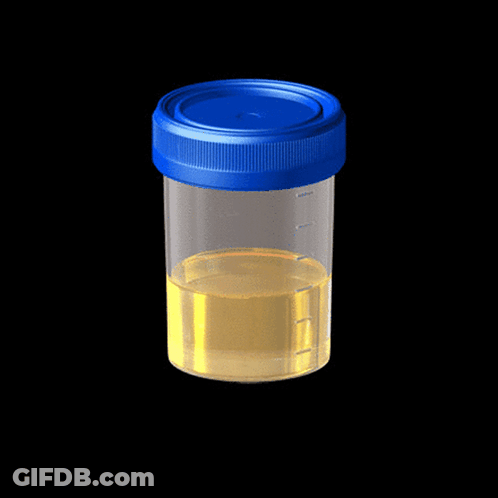 A Clear Container With A Blue Lid Filled With Urine GIF
