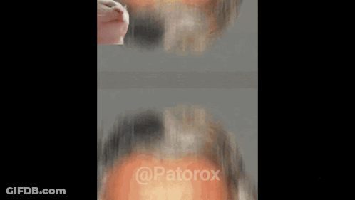 A Close Up Of A Man 'S Face With A Cat 'S Head On His Forehead . GIF