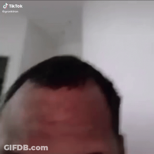A Close Up Of A Man 'S Head With A Very Long Haircut . GIF