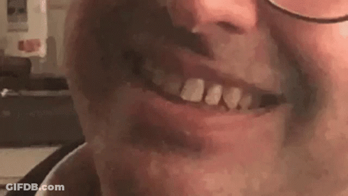 A Close Up Of A Man 'S Mouth With Glasses And A Missing Tooth . GIF
