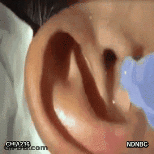 A Close Up Of A Person 'S Ear With Chia236 And Ndnbc Written On It GIF