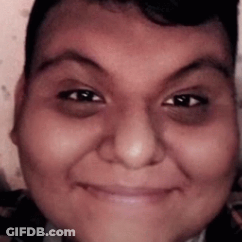 A Close Up Of A Person 'S Face With A Black Eye GIF