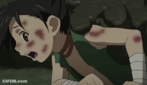 A Close Up Of A Person 'S Face With A Scar On It And A Mouth Open . GIF