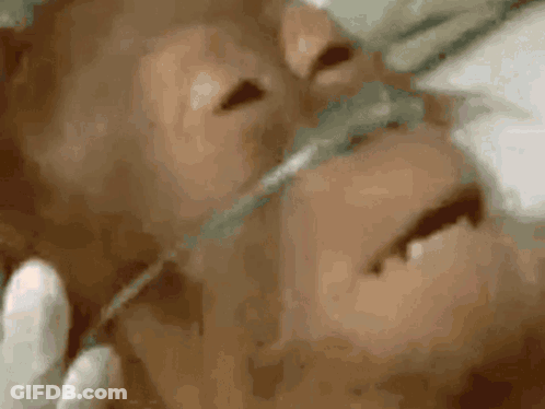 A Close Up Of A Person 'S Face With An Oxygen Mask GIF