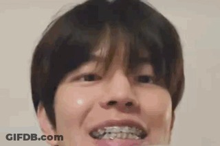 A Close Up Of A Person 'S Face With Braces On His Teeth . GIF
