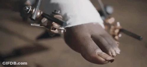 A Close Up Of A Person 'S Foot With A Bandage On It . GIF