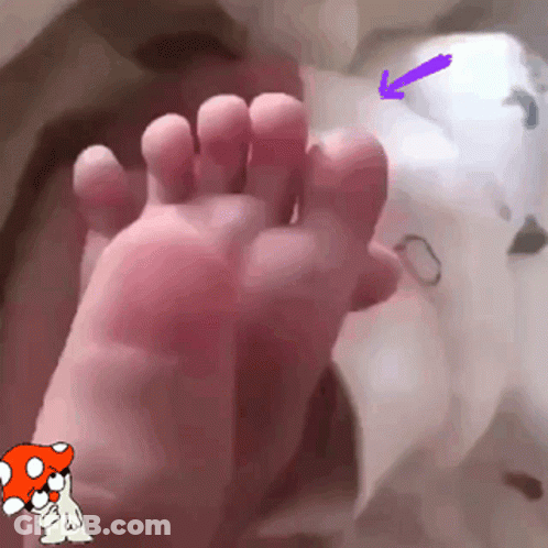 A Close Up Of A Person 'S Foot With A Mushroom And Arrow Pointing To The Toe . GIF