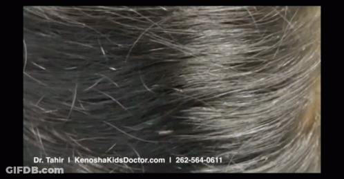 A Close Up Of A Person 'S Hair With Dr. Tahir I Kenoshakidsdoctor.com Written On The Bottom GIF
