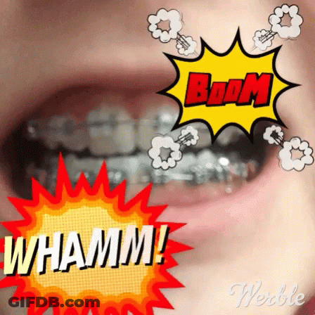 A Close Up Of A Person 'S Mouth With Braces And A Boom Sign GIF