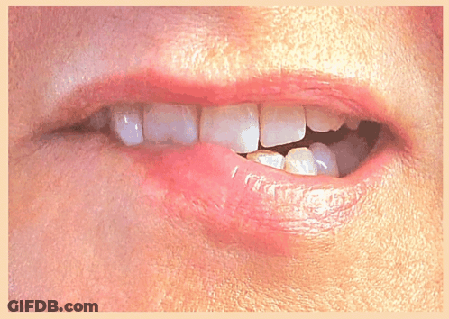 A Close Up Of A Person 'S Mouth With White Teeth And A Red Lip GIF