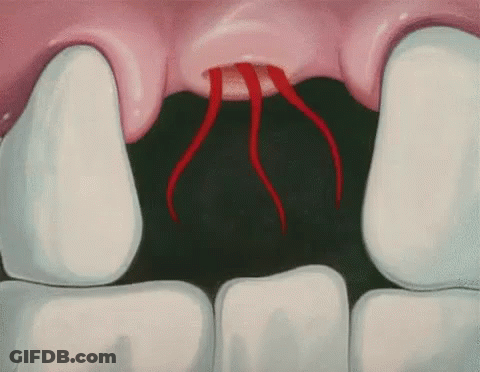 A Close Up Of A Person 'S Teeth With Blood Coming Out Of Them . GIF
