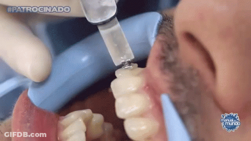A Close Up Of A Person 'S Teeth With The Words #Patrocinado On The Bottom Right GIF