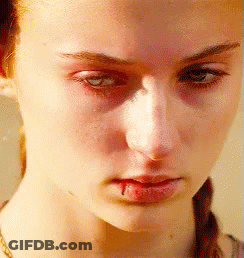 A Close Up Of A Woman 'S Face With Blood Coming Out Of Her Mouth . GIF