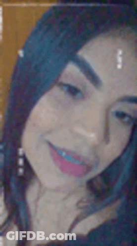 A Close Up Of A Woman 'S Face With Braces . GIF