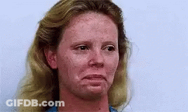 A Close Up Of A Woman 'S Face With Red Freckles . GIF