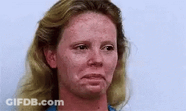 A Close Up Of A Woman 'S Face With Red Freckles . GIF