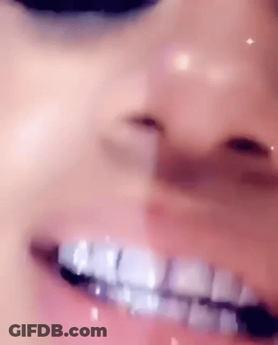 A Close Up Of A Woman 'S Mouth With Braces On Her Teeth And A Nose Ring . GIF
