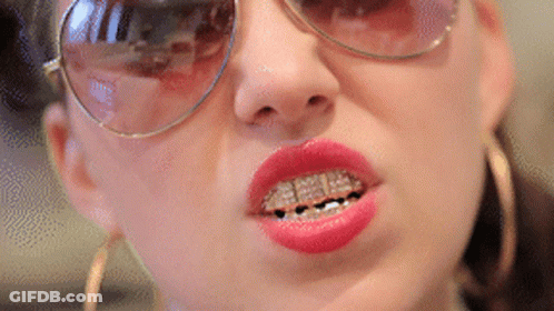 A Close Up Of A Woman Wearing Sunglasses And Braces GIF