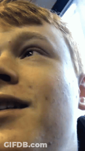 A Close Up Of A Young Man 'S Face With A Few Spots On It GIF