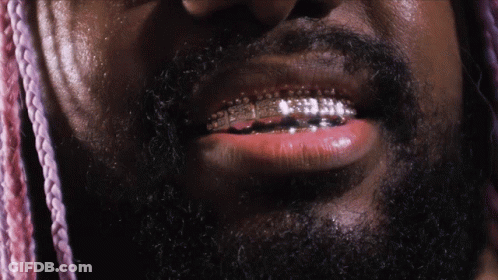 A Closeup Of A Man 'S Mouth With Braces On His Teeth GIF