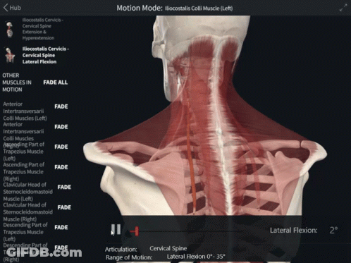 A Computer Screen Shows Muscles In Motion And The Motion Mode GIF