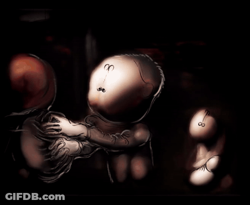 A Drawing Of A Person 'S Heart With A Clock On It GIF