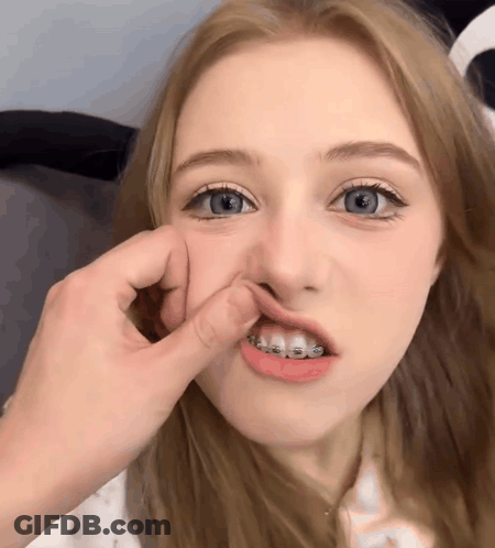 A Girl With Braces On Her Teeth Is Being Touched By A Person GIF