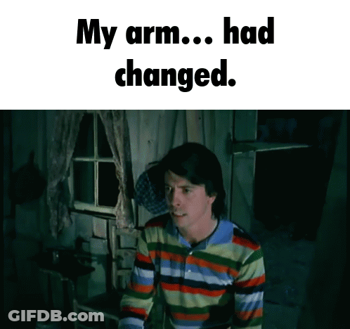 A Man In A Colorful Striped Shirt Says " My Arm ... Had Changed " GIF