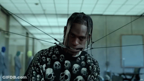 A Man Wearing A Black Shirt With Skulls On It Has A Brace On His Teeth GIF