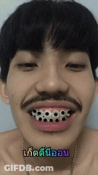 A Man With A Mustache And Braces On His Teeth Has A Smiley Face GIF