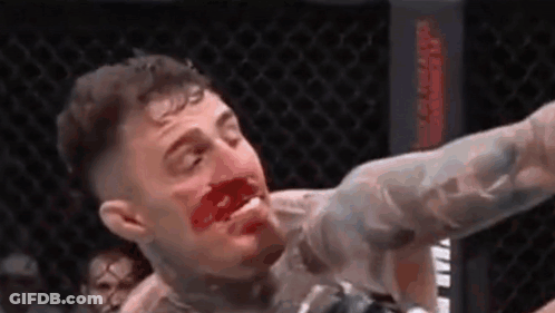 A Man With Blood On His Face Is Laying On The Ground In A Cage . GIF