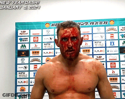 A Man With Blood On His Face Is Standing In Front Of A Sign That Says New Year Dash January 5Th 2024 GIF
