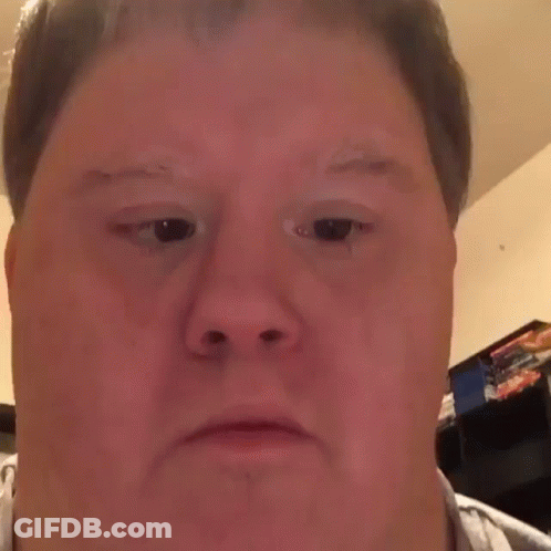 A Man With Down Syndrome Is Making A Funny Face With His Eyes Closed And His Mouth Open . GIF