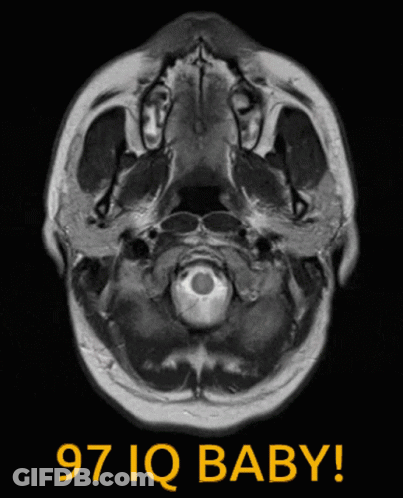 A Mri Scan Of A Baby 'S Head With The Words 97 Iq Baby Below It GIF