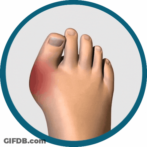 A Person 'S Foot With A Red Spot On The Toe GIF