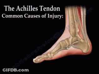 A Picture Of A Foot With The Words " The Achilles Tendon Common Causes Of Injury " On It GIF