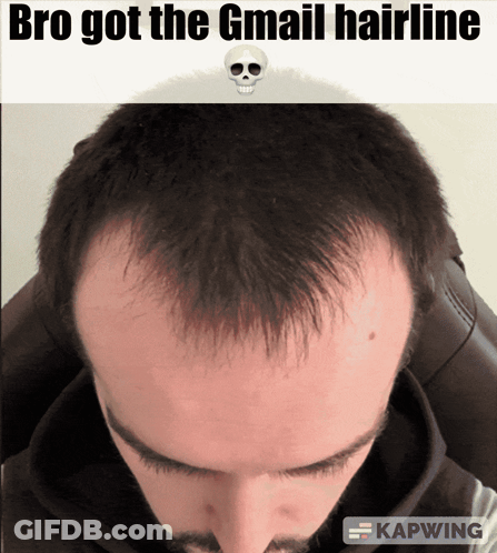 A Picture Of A Man 'S Head With The Caption " Bro Got The Gmail Hairline " GIF