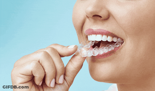 A Picture Of A Woman 'S Teeth With The Words New Orthodontic Aligners GIF