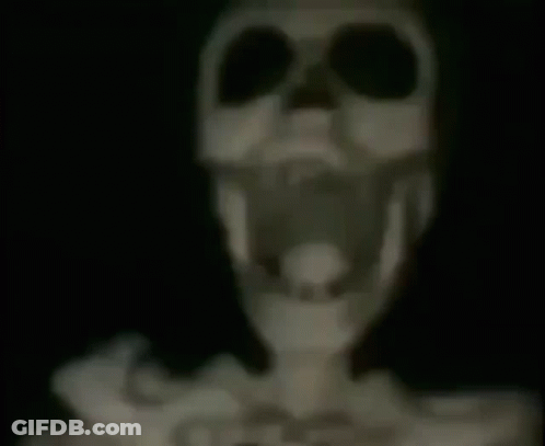 A Skeleton With Its Mouth Open Is Hanging From A Ceiling . GIF
