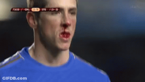 A Soccer Player Has A Bloody Nose During A Game Between Chil And Ste GIF