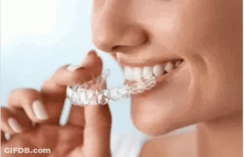A Woman Is Wearing A Clear Retainer On Her Teeth . GIF
