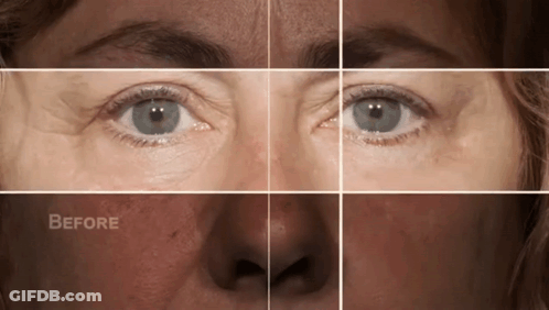 A Woman 'S Face Is Shown Before And After A Treatment GIF