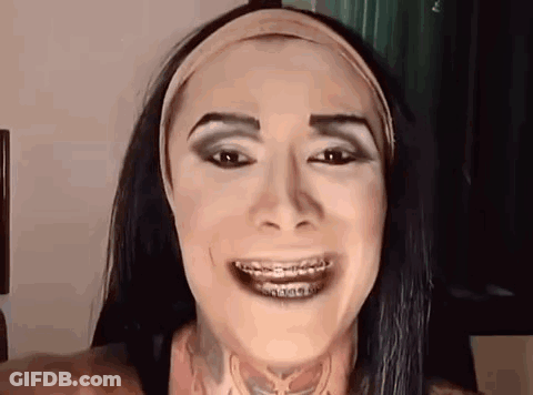 A Woman Wearing Braces And A Headband Is Smiling . GIF